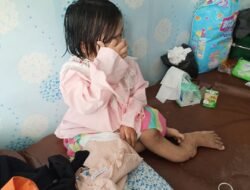 Bantuan dan Dukungan Terus Mengalir untuk Sang Anak yang Viral di Medsos, Diduga Disiksa oleh Keluarga Terdekat